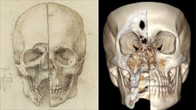 Leonardo DaVinci the First Skull Base Radiologist